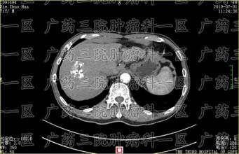 家属不幸阳性，肿瘤患者怎么办